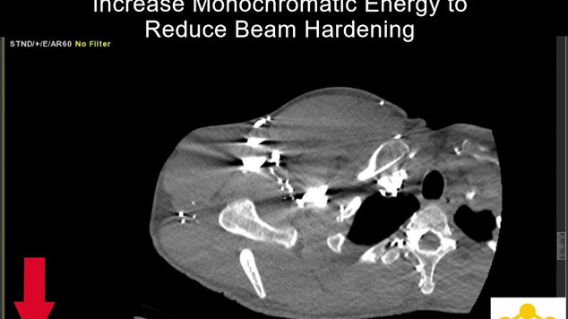 Case 24: DECT for Direct CTV